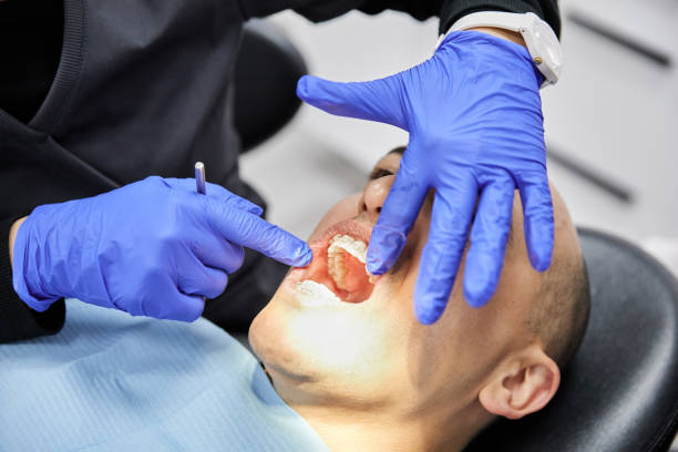 Best Emergency Tooth Extraction in Westerville, OH